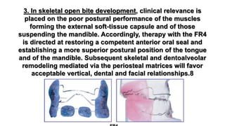 3. In skeletal open bite development, clinical relevance is
placed on the poor postural performance of the muscles
forming the external soft-tissue capsule and of those
suspending the mandible. Accordingly, therapy with the FR4
is directed at restoring a competent anterior oral seal and
establishing a more superior postural position of the tongue
and of the mandible. Subsequent skeletal and dentoalveolar
remodeling mediated via the periosteal matrices will favor
acceptable vertical, dental and facial relationships.8
 