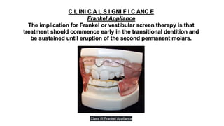 C L INI C A L S I GNI F I C ANC E
Frankel Appliance
The implication for Frankel or vestibular screen therapy is that
treatment should commence early in the transitional dentition and
be sustained until eruption of the second permanent molars.
 