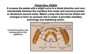 Palatal Bow (PABO)
It crosses the palate with a slight curve in a distal direction and runs
interdentally between the maxillary first molar and second premolar
or deciduous second molar. Makes a loop into the buccal shield and
emerges to form an occlusal rest in molar. It provides maxillary
anchorage and stabilizing action.
Frankel II (superior view
showing parts of the
appliance)
 