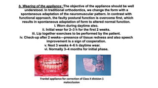 b. Wearing of the appliance :The objective of the appliance should be well
understood. In traditional orthodontics, we change the form with a
spontaneous adaptation of the neuromuscular pattern. In contrast with
functional approach, the faulty postural function is overcome first, which
results in spontaneous adaptation of form to altered normal function.
i. Worn during daytime also.
ii. Initial wear for 2–3 h for the first 2 weeks.
iii. Lip together exercises to be performed by the patient.
iv. Check-up after 2 weeks—presence of tissue redness and also speech
improvement is a sign of cooperation.
v. Next 3 weeks 4–6 h daytime wear.
vi. Normally 3–4 months for initial phase.
Frankel appliance for correction of Class II division 1
malocclusion
 