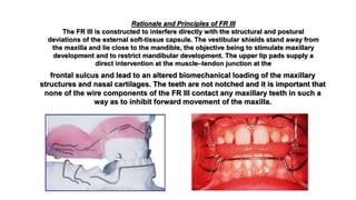 Rationale and Principles of FR III
The FR III is constructed to interfere directly with the structural and postural
deviations of the external soft-tissue capsule. The vestibular shields stand away from
the maxilla and lie close to the mandible, the objective being to stimulate maxillary
development and to restrict mandibular development. The upper lip pads supply a
direct intervention at the muscle–tendon junction at the
frontal sulcus and lead to an altered biomechanical loading of the maxillary
structures and nasal cartilages. The teeth are not notched and it is important that
none of the wire components of the FR III contact any maxillary teeth in such a
way as to inhibit forward movement of the maxilla.
 