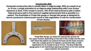 Construction Bite
Horizontal construction bite is usually taken in edge-to-edge. With an overjet of up
to 10 mm, a single activation to an edge-to-edge relationship with 2 mm incisor
clearance is done. If the overjet is severe, 70% of the total protrusive path is taken.
Total protrusive path is the maximum sagittal advancement that is possible in a
patient. The Exactobite or Projet bite gauge or George bite gauge is designed to
record a protrusive interocclusal record or bite registration in wax for construction
of twin blocks.
Projet Bite Gauge: (a) select the appropriate groove for
the upper incisors depending on the size of the overjet and the ease
with which the patient can posture forward; (b) the lower incisors
bite into a single groove to register a protrusive bite; (c) bite
registration for an overjet of up to 10 mm. The blue Projet bite
gauge gives 2 mm interincisal opening and there is 5–6 mm vertical
space between the premolars
 