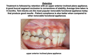 Retention
Treatment is followed by retention with an upper anterior inclined plane appliance.
A good buccal segment occlusion is cornerstone of stability. Average time taken is
9 months. Twin blocks are the most popular removable functional appliance today
that produce good results . Patient compliance is also better when compared to
other removable functional appliances.
upper anterior inclined plane appliance
 