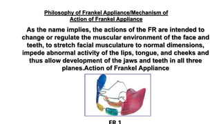 As the name implies, the actions of the FR are intended to
change or regulate the muscular environment of the face and
teeth, to stretch facial musculature to normal dimensions,
impede abnormal activity of the lips, tongue, and cheeks and
thus allow development of the jaws and teeth in all three
planes.Action of Frankel Appliance
Philosophy of Frankel Appliance/Mechanism of
Action of Frankel Appliance
 