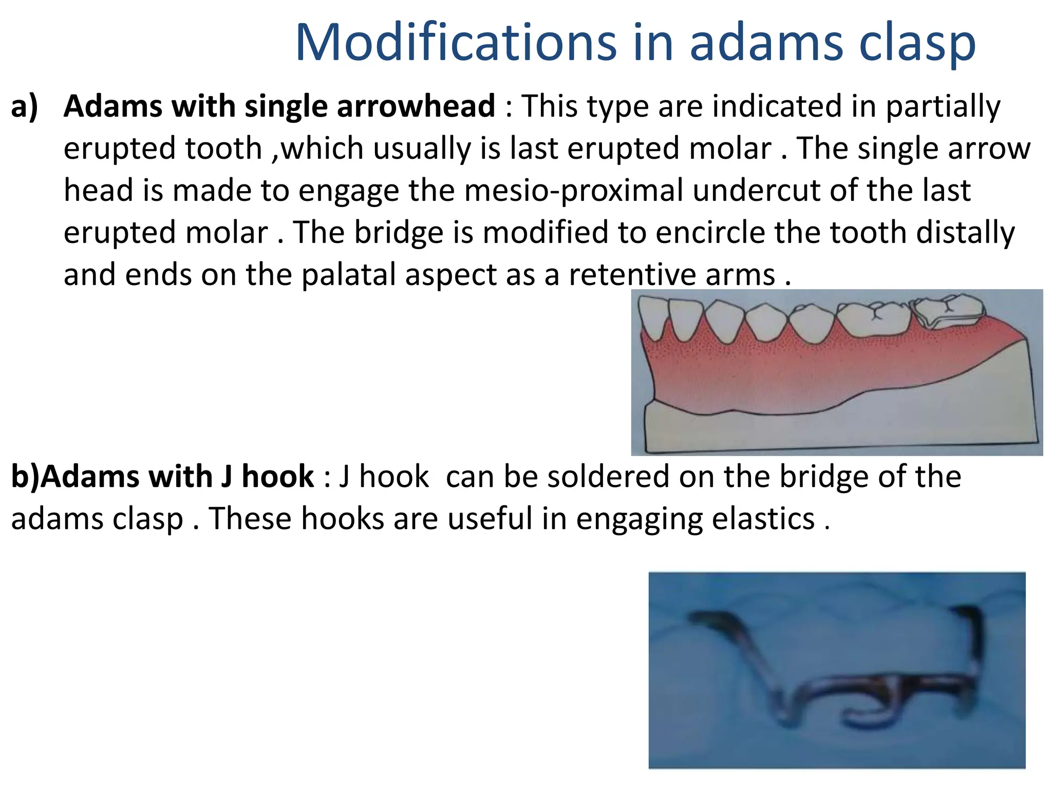removable orthodontic appliences for UG.pdf
