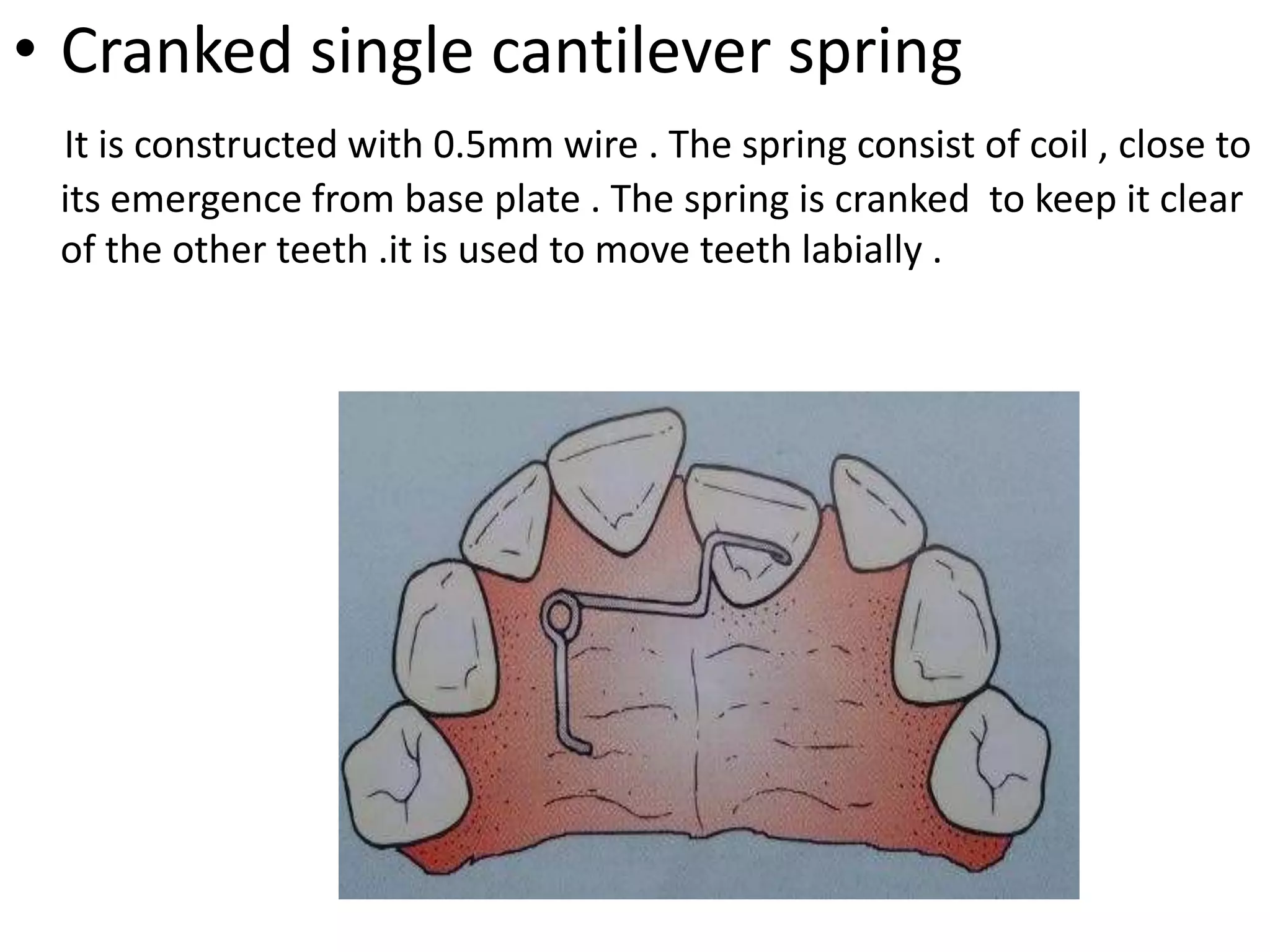 Removable orthodontic appliance | PPTX