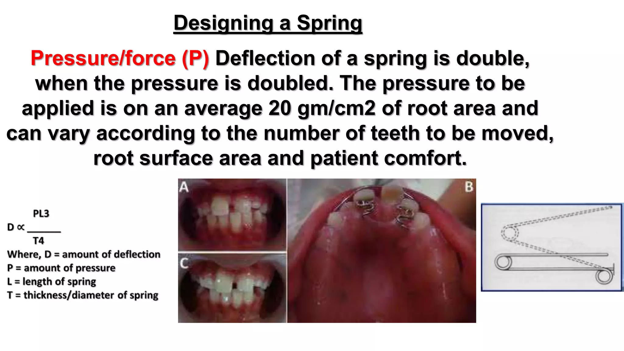 Removable orthodontic appliance | PPTX