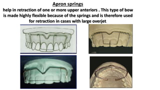 Removable orthodontic appliance | PPTX