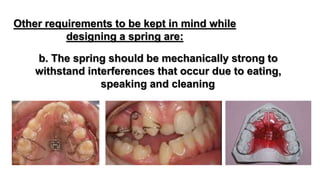 Removable orthodontic appliance | PPTX