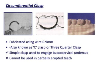 Removable Orthodontic Appliances Analhaq Shaikh | PPTX