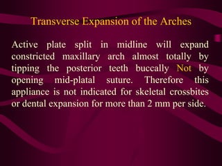 Transverse Expansion of the Arches
Active plate split in midline will expand
constricted maxillary arch almost totally by
...