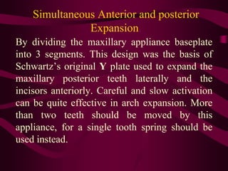 Simultaneous Anterior and posterior
Expansion.
By dividing the maxillary appliance baseplate
into 3 segments. This design ...