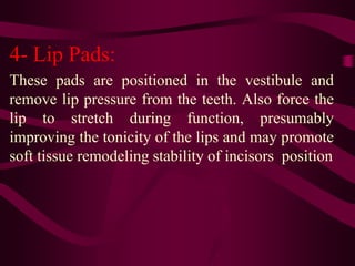6- Lingual Shields:
Remove the resting tongue from between the teeth
therefore reduce the force tooth eruption while
poste...