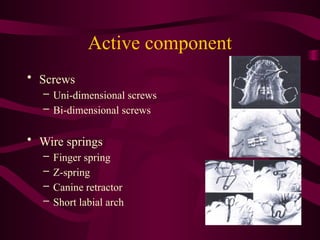 Removable Orthodontic Appliances Removable Orthodontic Appliances | PPTX