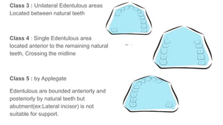Class 3 : Unilateral Edentulous areas
Located between natural teeth
Class 4 : Single Edentulous area
located anterior to the remaining natural
teeth, Crossing the midline
Class 5 : by Applegate
Edentulous are bounded anteriorly and
posteriorly by natural teeth but
abutment(ex:Lateral incisor) is not
suitable for support.
 