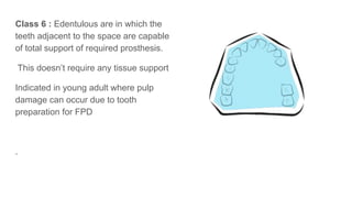 Class 6 : Edentulous are in which the
teeth adjacent to the space are capable
of total support of required prosthesis.
This doesn’t require any tissue support
Indicated in young adult where pulp
damage can occur due to tooth
preparation for FPD
.
 