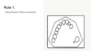 Rule 1.
Classification Follow extraction
 