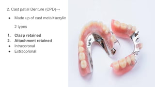 2. Cast patial Denture (CPD)→
● Made up of cast metal+acrylic
2 types
1. Clasp retained
2. Attachment retained
● Intracoronal
● Extracoronal
 