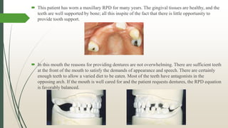 Temp Max Rpd Removable Partial Denture Equation | PPTX