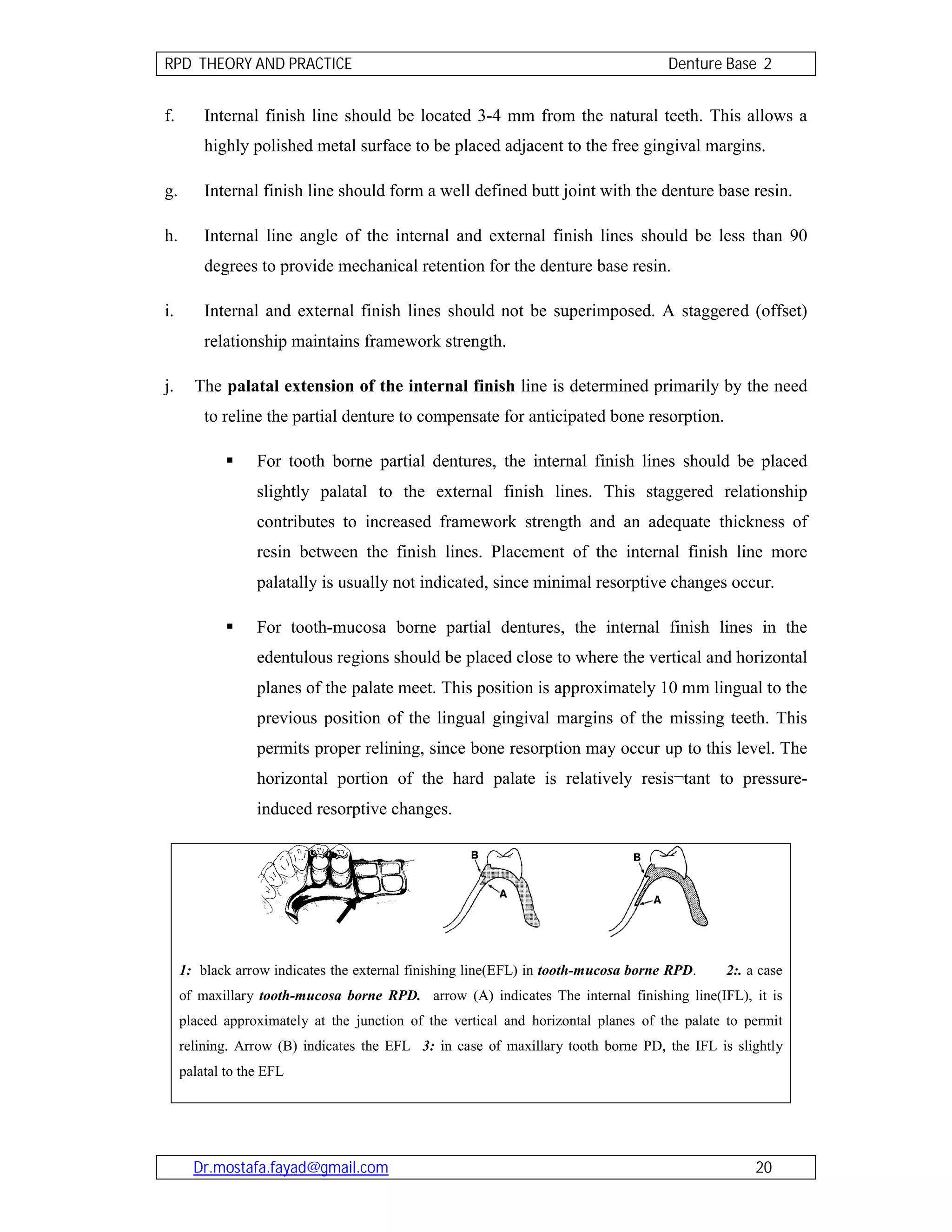 Removable partial denture theory and practice 2011 | PDF