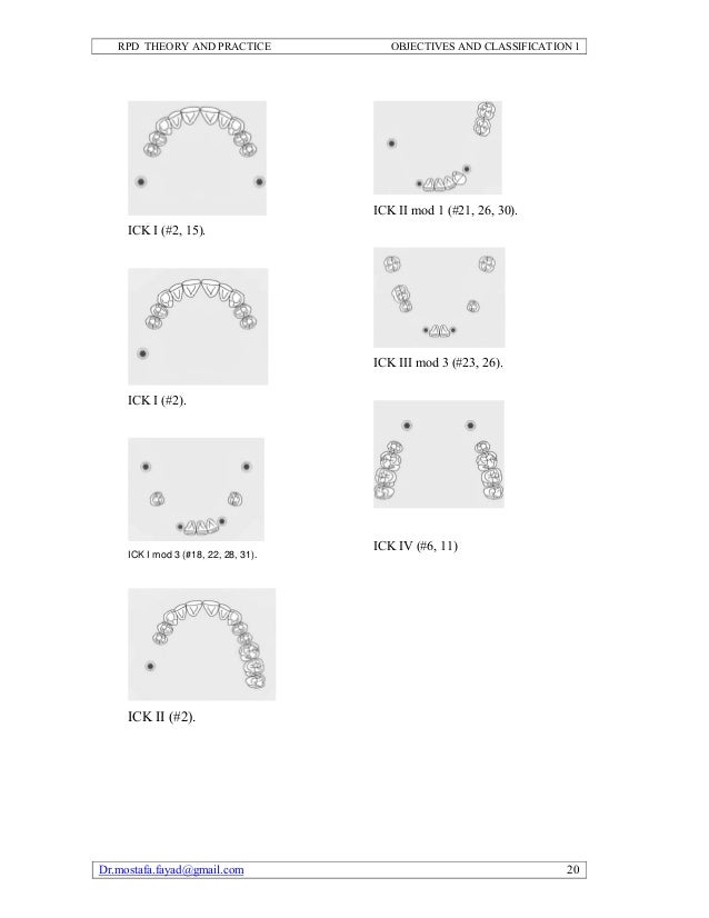 Removable partial denture theory and practice 2011
