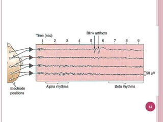 Removal of artifacts in EEG by averaging and | PPTX