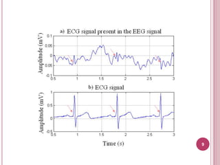 Removal of artifacts in EEG by averaging and | PPTX