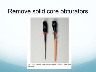 Remove solid core obturators
 