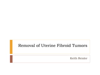 Removal of Uterine Fibroid Tumors
Keith Reisler
 