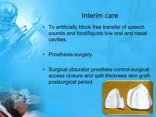 Interim careTo artificially block free transfer of speech sounds and food/liquids b/w oral and nasal cavities.Prosthesis-surgery.Surgical obturatorprostheis-control-surgical access closure and split thickness skin graft-postsurgical period.