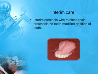 Interim careInterim prostheis-wire retained resin prosthesis-no teeth-modified-addition of teeth.