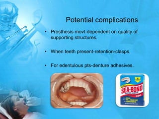 Potential complicationsProsthesis movt-dependent on quality of supporting structures.When teeth present-retention-clasps.For edentulous pts-denture adhesives.