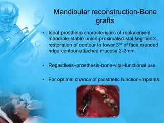 Mandibular reconstruction-Bone graftsIdeal prosthetic characteristics of replacement mandible-stable union-proximal&distal segments, restoration of contour to lower 3rd of face,rounded ridge contour-attached mucosa 2-3mm.Regardless–prosthesis-bone-vital-functional use.For optimal chance of prosthetic function-implants.