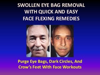 SWOLLEN EYE BAG REMOVAL
WITH QUICK AND EASY
FACE FLEXING REMEDIES
Purge Eye Bags, Dark Circles, And
Crow’s Feet With Face Workouts
 