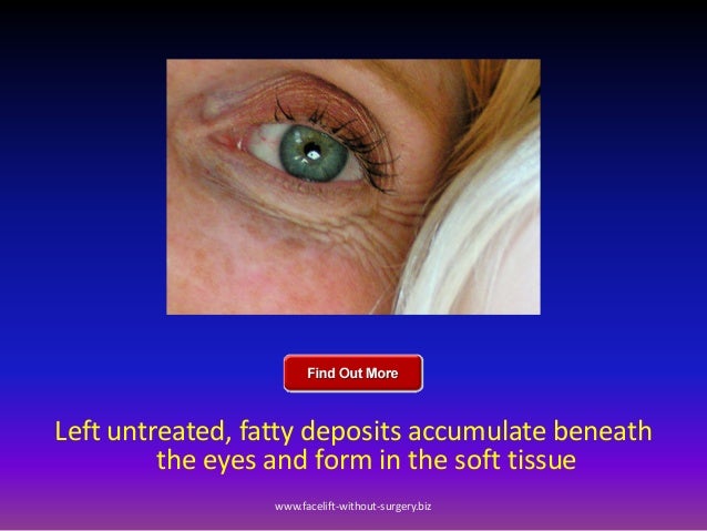 What causes fatty deposits in the eye?
