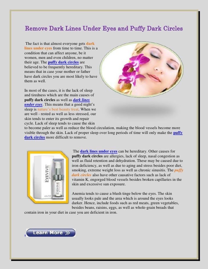 Remove dark lines under eyes and puffy dark circles