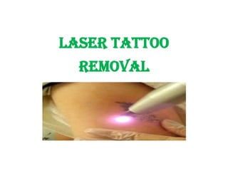 Pure Vision Tattoo  Abbotsford  Body treatments  Bookwell