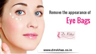 Remove the appearance of
Eye Bags
www.drrekhas.co.in
 