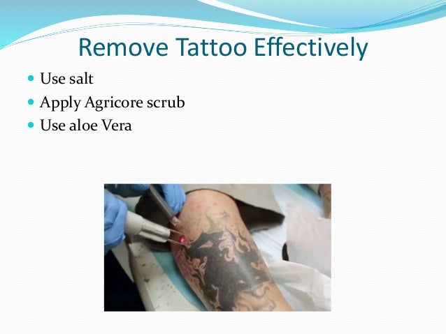 tips for removing a tattoo frank lao ifa tips for removing a tattoo frank lao ifa