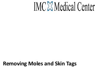 Removing Moles and Skin Tags
 