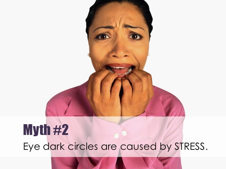 Removing raccoon eyes