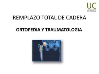 REMPLAZO TOTAL DE CADERA
ORTOPEDIA Y TRAUMATOLOGIA
 