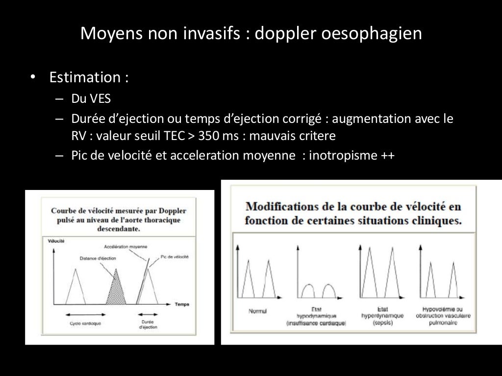 Remplissage vasculaire en anesthesie