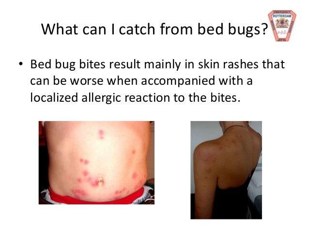 Bed Bug Transmission Person To Person Bed Bug Transmission Person To Person