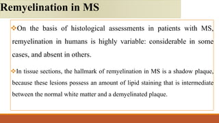 On the basis of histological assessments in patients with MS,
remyelination in humans is highly variable: considerable in some
cases, and absent in others.
In tissue sections, the hallmark of remyelination in MS is a shadow plaque,
because these lesions possess an amount of lipid staining that is intermediate
between the normal white matter and a demyelinated plaque.
Remyelination in MS
 