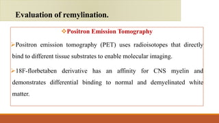 Positron Emission Tomography
Positron emission tomography (PET) uses radioisotopes that directly
bind to different tissue substrates to enable molecular imaging.
18F-florbetaben derivative has an affinity for CNS myelin and
demonstrates differential binding to normal and demyelinated white
matter.
Evaluation of remylination.
 