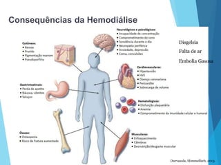 Consequências da Hemodiálise
Durvasula, Himmelfarb, 2013.
Disgelsia
Falta de ar
Embolia Gasosa
 