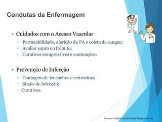• Cuidados com o Acesso Vascular
▫ Permeabilidade, aferição da PA e coleta de sangue;
▫ Avaliar sopro ou frêmito;
▫ Curativos compressivos e contenções.
• Prevenção de Infecção
▫ Contagem de leucócitos e eritrócitos;
▫ Sinais de infecção;
▫ Curativos.
Brunner, Suddart (2011); Google Imagens (2016).
Condutas da Enfermagem
 