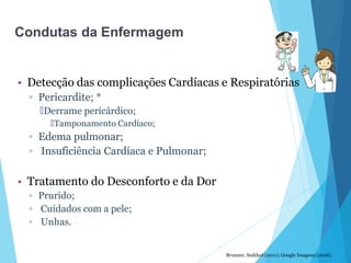 • Detecção das complicações Cardíacas e Respiratórias
▫ Pericardite; *
🞄Derrame pericárdico;
🞄Tamponamento Cardíaco;
▫ Edema pulmonar;
▫ Insuficiência Cardíaca e Pulmonar;
• Tratamento do Desconforto e da Dor
▫ Prurido;
▫ Cuidados com a pele;
▫ Unhas.
Brunner, Suddart (2011); Google Imagens (2016).
Condutas da Enfermagem
 