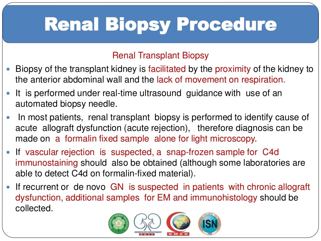 Renal biopsy